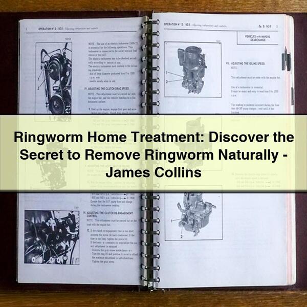 Ringworm Home Treatment: Discover the Secret to Remove Ringworm Naturally-James Collins
