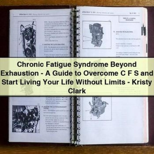 Chronic Fatigue Syndrome Beyond Exhaustion: Overcome CFS Start Living Your Life Without Limits - Kristy Clark Service Repair Workshop Manual PDF